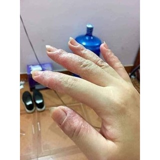 [shop yêu thích] Kem Bôi Da Lan Chi [siêu rẻ]