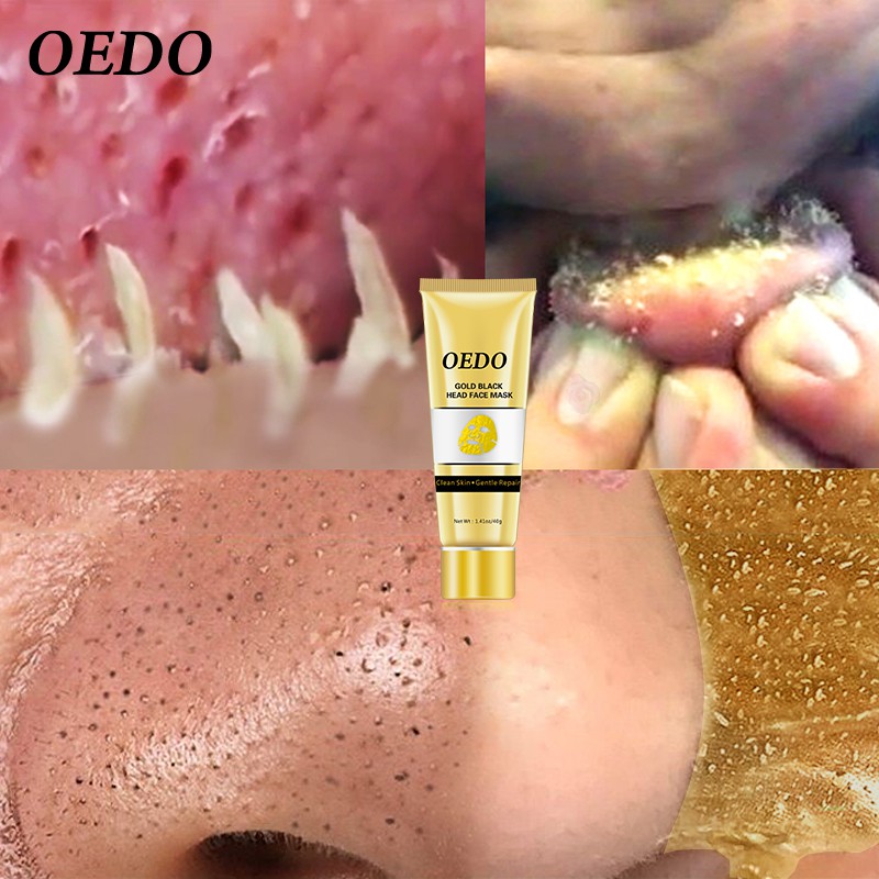 OEDO Serum chứa hyaluronic acid dưỡng ẩm + 2 mặt nạ vàng loại bỏ lớp mụn đầu đen cấp ẩm dưỡng trắng và làm sạch sâu