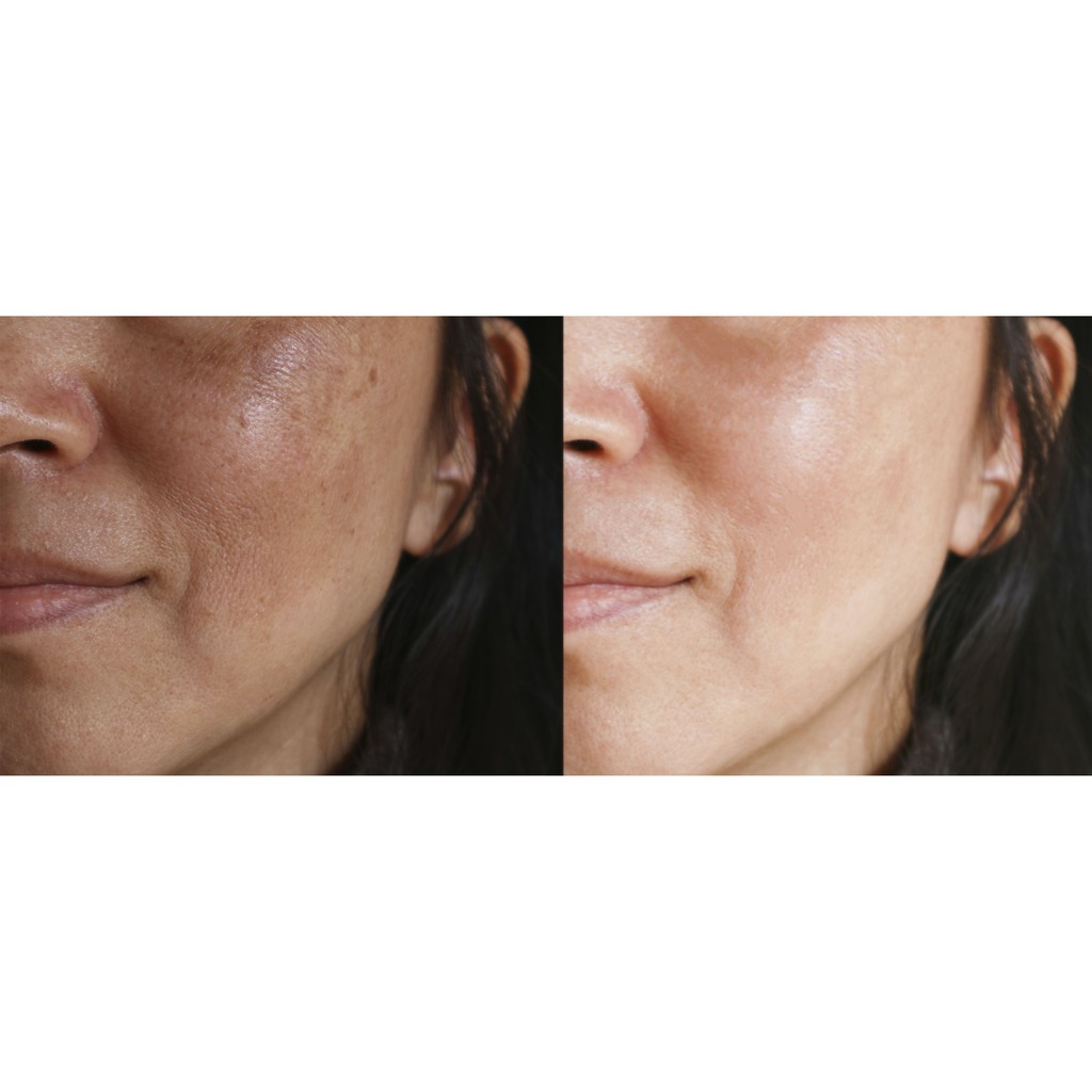 [FULLSIZE 30ML- BILL US] TINH CHẤT SÁNG DA THE INKEY LIST 15% TITAMIN C AND EGF BRIGHTENING SERUM
