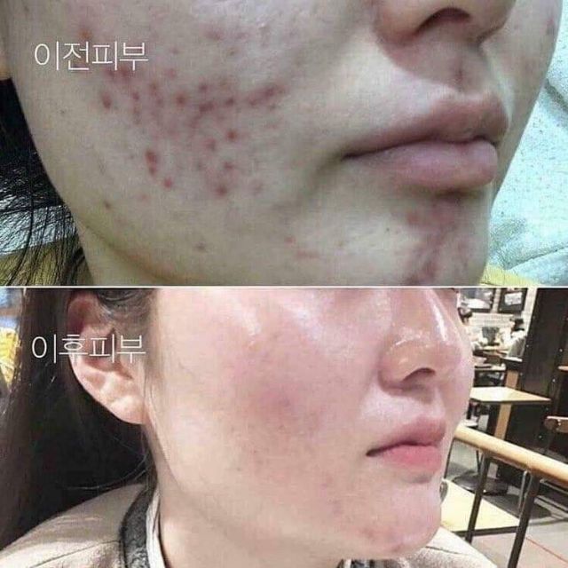 Red Peel Serum Sample