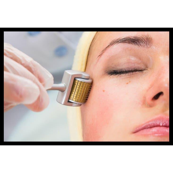 Kim Lăn Kim Titan 540 Kim Rhe5 Kim