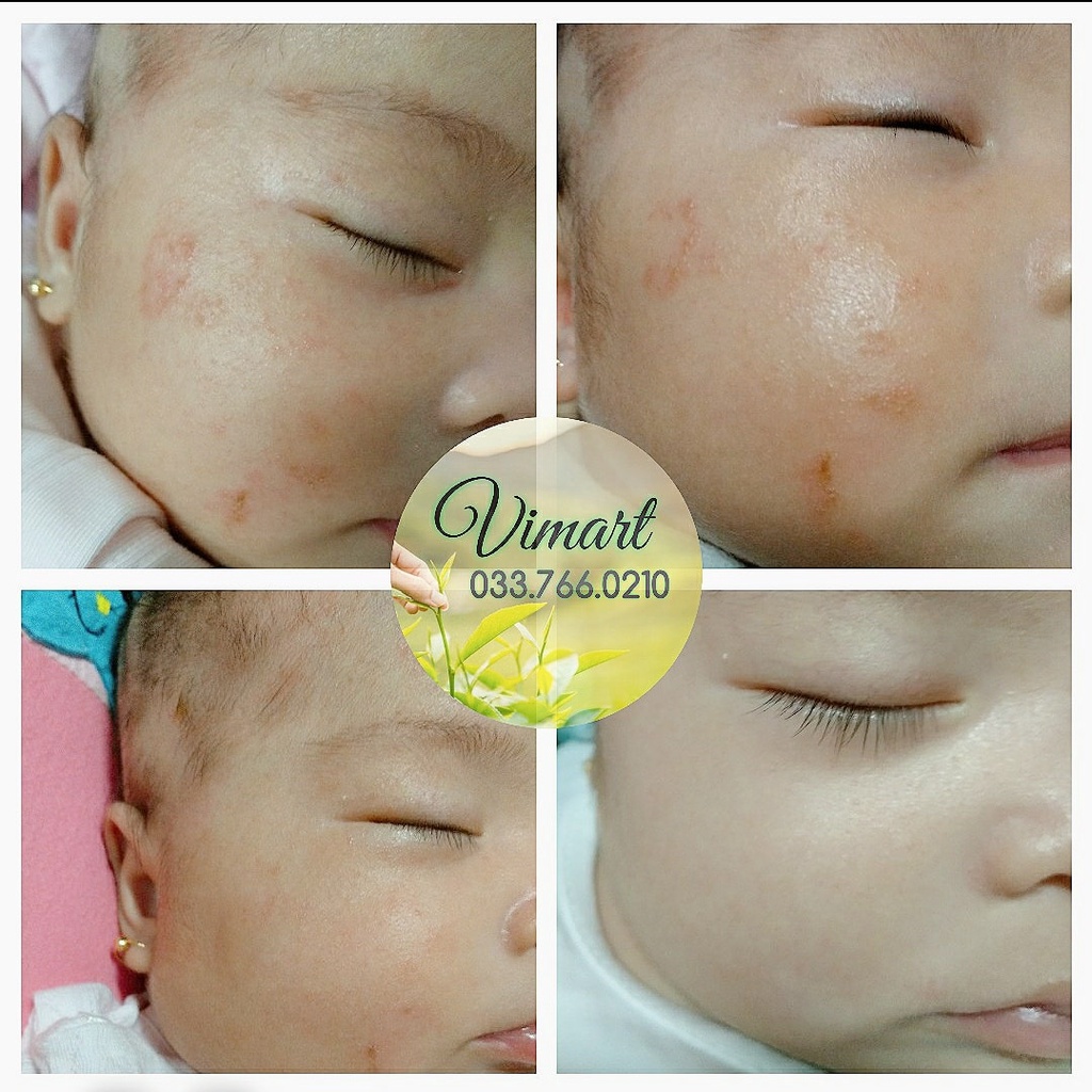 Kem Đa Năng Lucas Papaw Ointment Úc 25gram/ 75gram