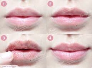 Tẩy Tế Bào Chết Môi