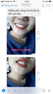 MIẾNG DÁN RĂNG ORAL B 3D WHITE WHITESTRIPS