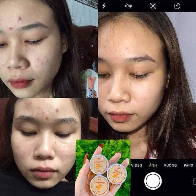 Cao mụn sâm đỏ MEEA ORGANIC mini size 5g