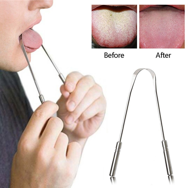 1 Dụng Cụ Vệ Sinh Lưỡi Bằng Thép Không Gỉ