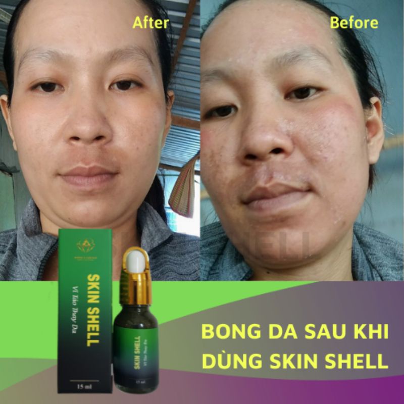 PEEL DA VI TẢO SKIN SHELL