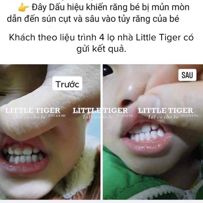 TẶNG BÀN CHẢI- Xịt Chống Sâu Răng MIDKID - bảo vệ men răng ,ngừa ố vàng (dành cho bé từ 1 tuổi)