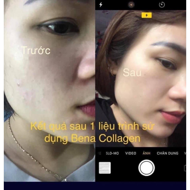 [FREESHIP] COMBO 3 hộp collagen- ngăn ngừa quá trình lão hoá | BigBuy360 - bigbuy360.vn