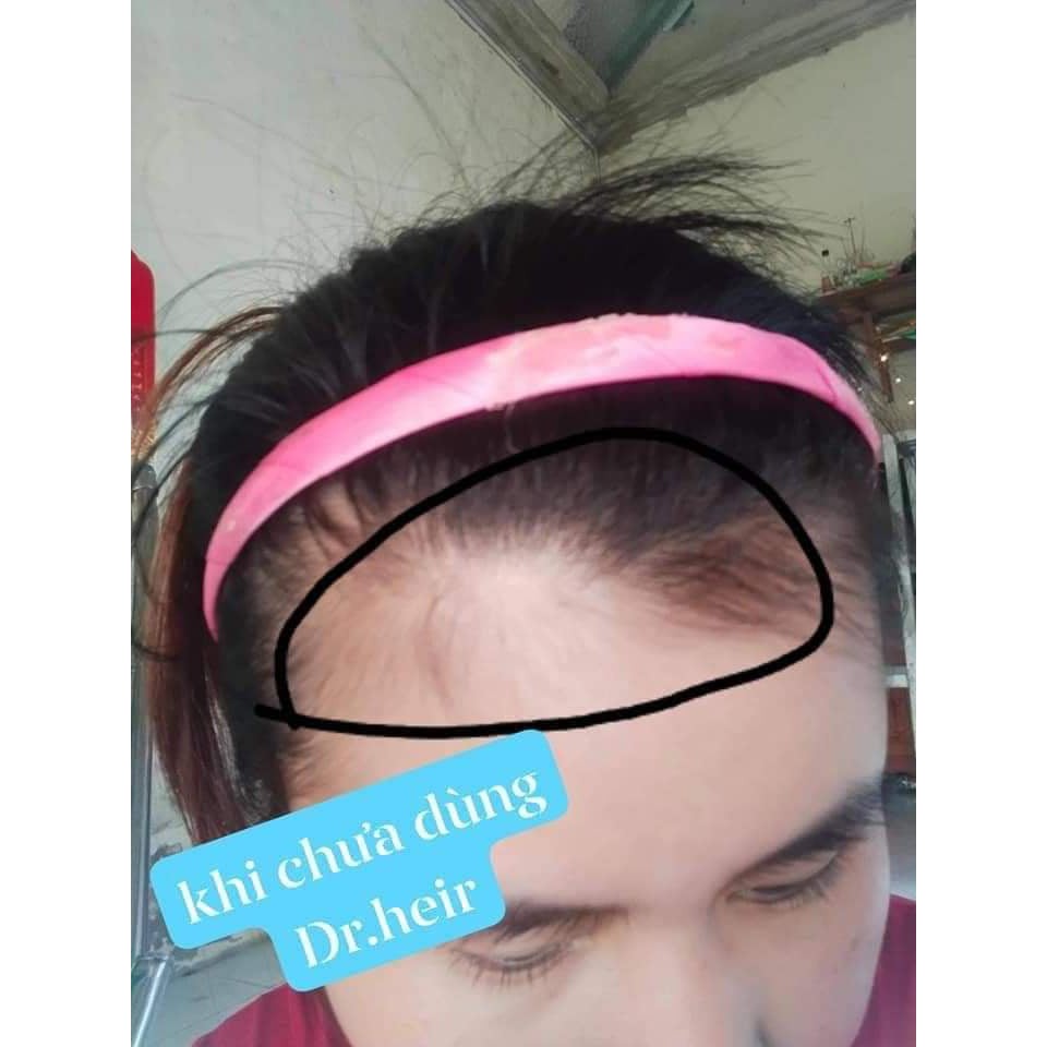 Dr.Hair Zenpali Dài Mi, Dầy Mày, Kích Mọc Tóc | BigBuy360 - bigbuy360.vn