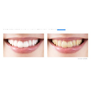 Bột trắng răng Apalight nội địa Nhật