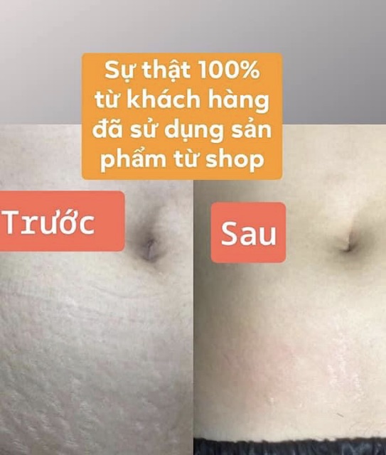 Kem rạn thần thánh Stretcheal