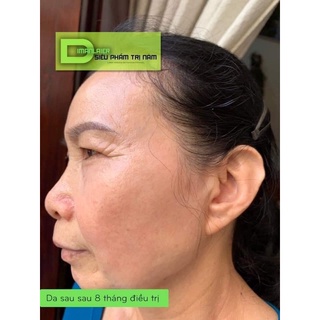 kem dưỡng ẩm quế chi dimanlaier