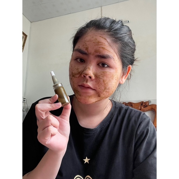𝙋𝙚𝙚𝙡 𝙙𝙖 𝙧𝙚𝙩𝙞𝙣𝙤𝙡 𝙫𝙞 𝙩𝙖̉𝙤 mẫu chai 10ml