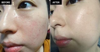 Toner Dr.pepti nước thần