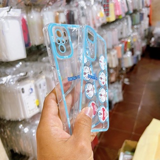 Ốp lưng lỗ viền camera Xiaomi Redmi Note 10 Note 10s Note 11 Note11s Note 10 Pro Note 11 Pro 4G Redmi 10A Redmi 9C