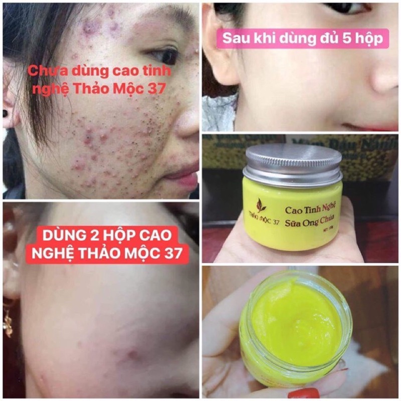 [Chính Hãng] 1h Cao Tinh Nghệ Sữa Ong Chúa Thảo Mộc 37