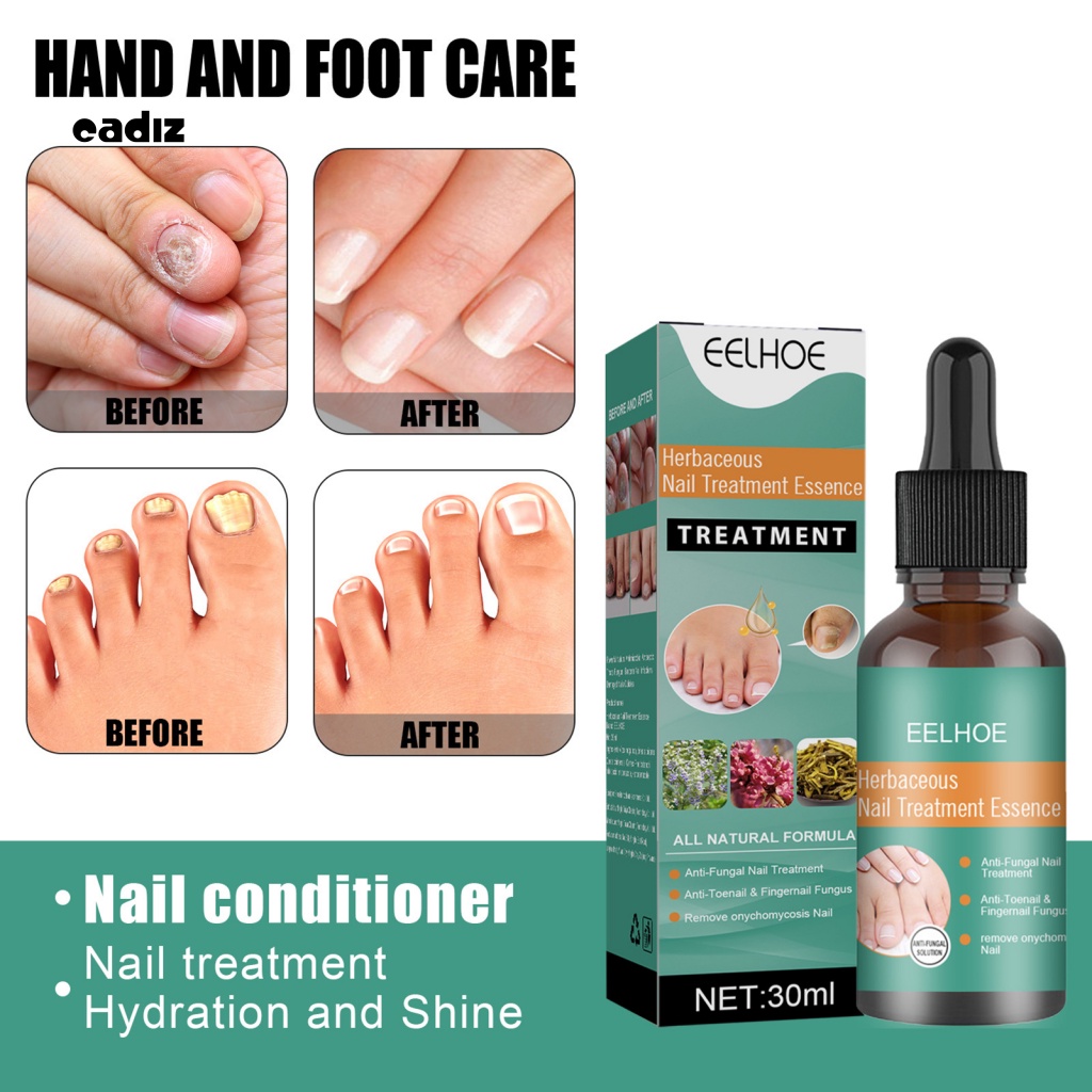 Lotion Dưỡng Chăm Sóc Móng Tay Chăm Sóc Sức Khỏe Cho Người Lớn