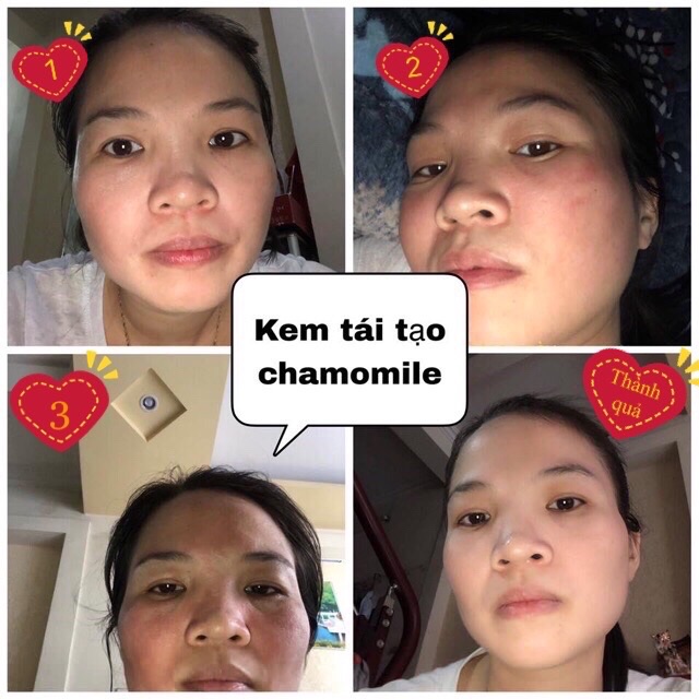 Combo Kem tái tạo + Hồng Sâm chamomile