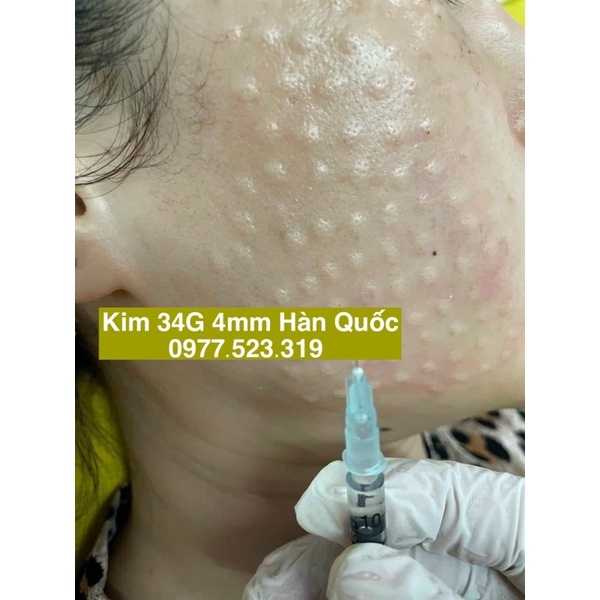 Kim Tiêm Meso 34G 4mm Nanoneedle Hàn Quốc