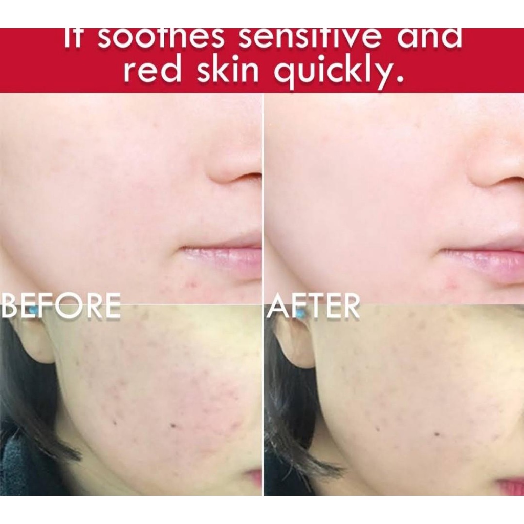 Kem dưỡng ẩm Illiyoon Ceramide Ato 500ml cô đặc chăm sóc da cao cấp