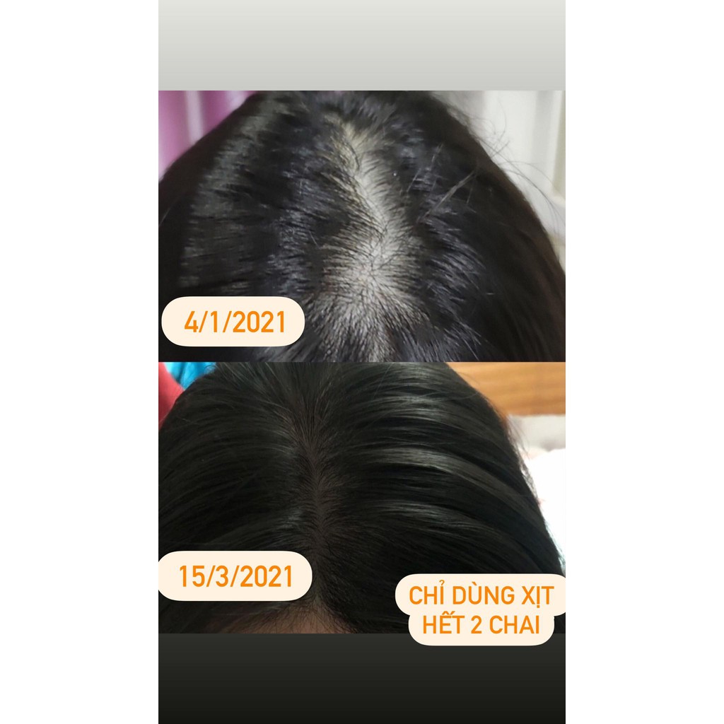 Tinh dầu dưỡng tóc bưởi Vijully kích mọc tóc, giảm rụng, làm dày tóc, hết bết, nhanh dài 100ml - TẶNG KÈM QUÀ XINH | BigBuy360 - bigbuy360.vn