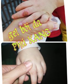 Gel bôi da Phú KANG