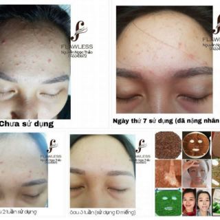 Mặt nạ Seaweed mask