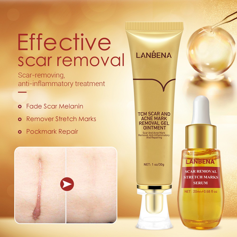 Set 2 Mỹ Phẩm Chăm Sóc Da LANBENA Gồm Serum Xóa Sẹo Mụn+Kem Làm Trắng Mụn Đầu Đen Thu Nhỏ Lỗ Chân Lông Làm Mờ Vết Rạn Da | BigBuy360 - bigbuy360.vn