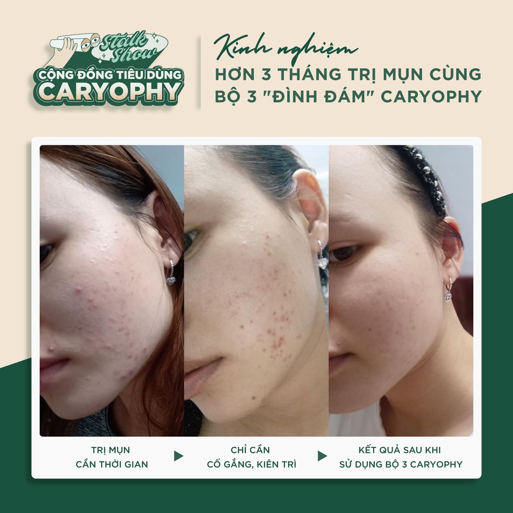 Combo 3 bước giảm mụn mờ thâm Caryophy