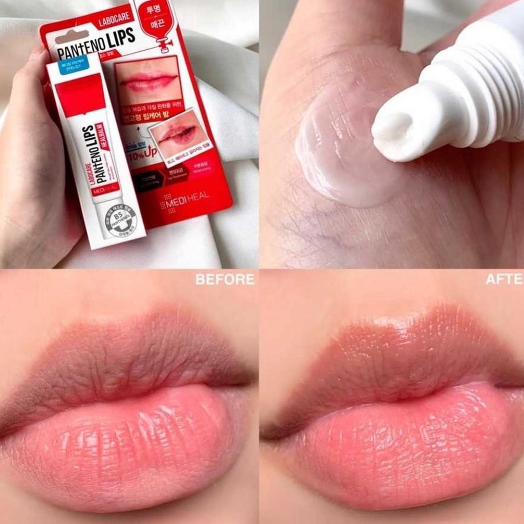 Son Dưỡng Giảm Thâm Môi Mediheal LABOCARE PANtENO LIPS 10ml