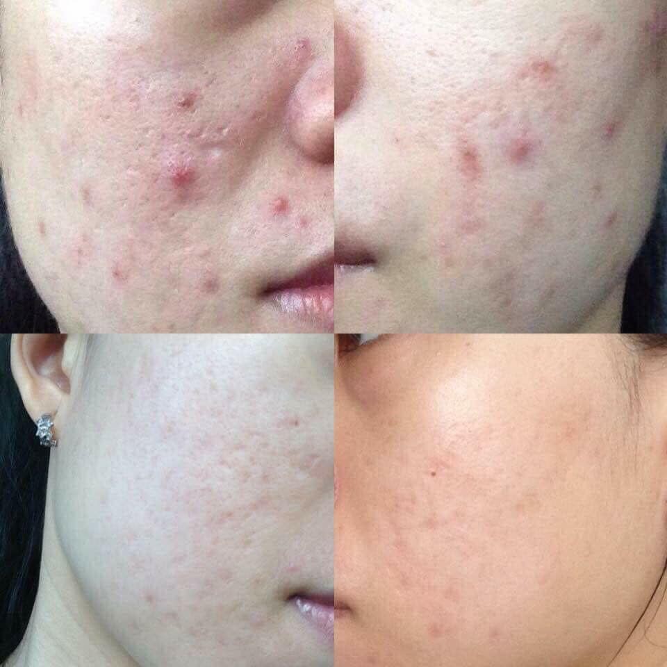 10 GÓI TINH CHẤT VÀNG ĐÊM OHUI GIÚP TÁI SINH DA, SE KHÍT LỖ CHÂN LÔNG, NGĂN NGỪA LÃO HÓA