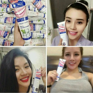 Kem Đánh Răng Trắng Sáng Sparkle 60gr - 100gr
