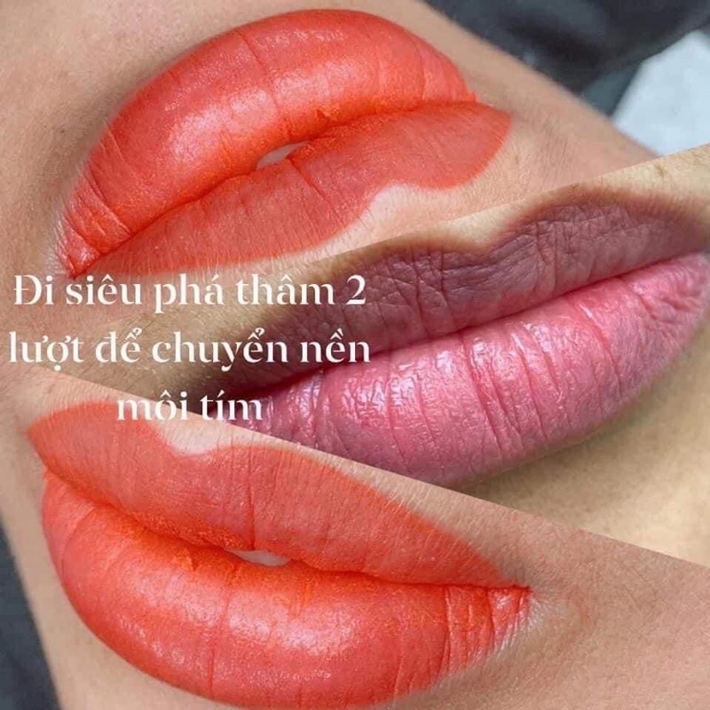 Mực HT siêu phá thâm hót nhất thị trường hiện nay