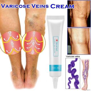 (Hàng Mới Về) Thuốc Mỡ Trị Suy Giãn Tĩnh Mạch An Toàn Và Hiệu Quả