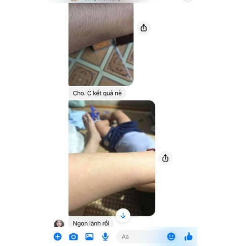 Máy triệt lông Homedics Duo Lux UK-IPL-HH390. Máy triệt lông Homedics Duo Lite HH180 nhập khẩu USA