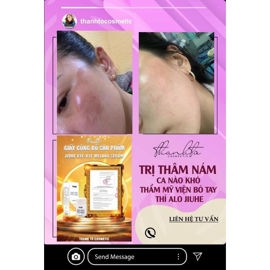 JiuHe Bye-Bye MeLaNo