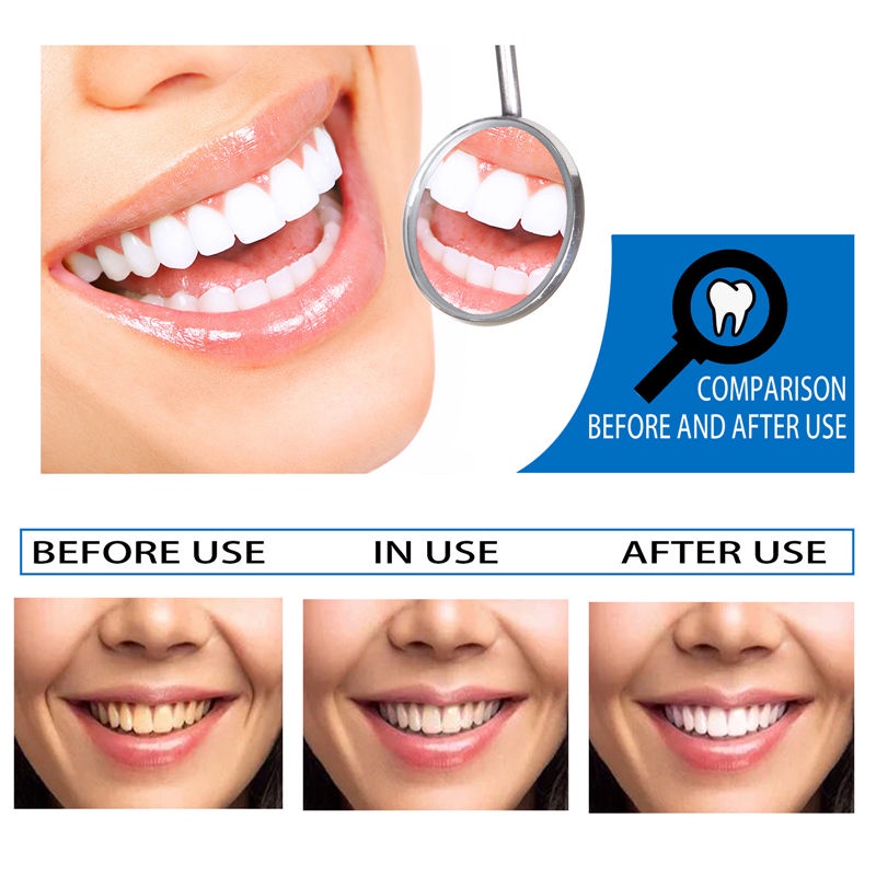 Tinh Chất Vệ Sinh Răng Miệng EELHOE Làm Trắng Loại Bỏ Vết Bẩn Hiệu Quả 10ml