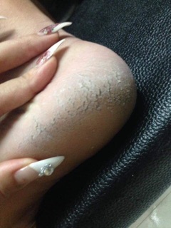 Máy Chà gót chân ,làm sạch bề mặt dày sừng gót chân