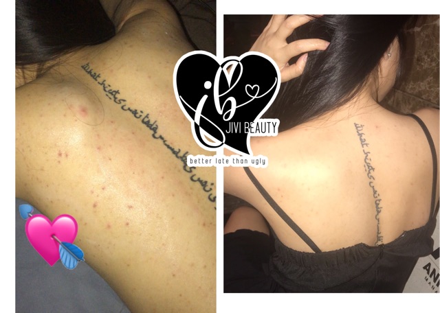 KEM THÂM THẢO DƯỢC