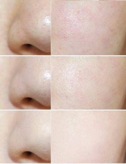 PHẤN PHỦ BABY SHISEIDO