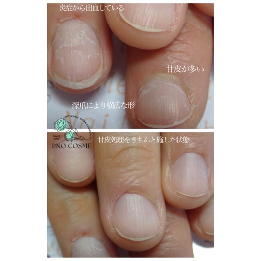 Gel dưỡng móng NAIL NAIL OIL GEL TREATMENT - phục hồi móng hư tổn