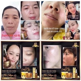 kem face collagen X3