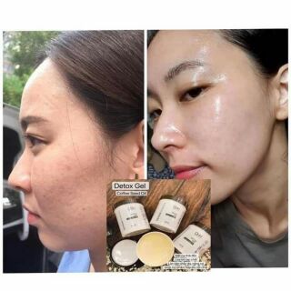 DBH mặt nạ thải độc da