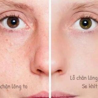 Serum Se Lỗ Chân Lông (estee lauder idealist Pore Minimizing)