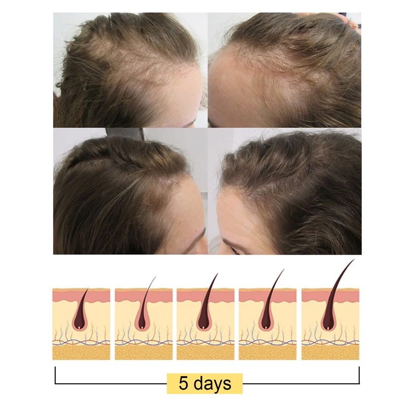 Xà Phòng Gội Đầu Chiết Xuất Gạo Phục Hồi Tóc Khô Hư Tổn Dưỡng Ẩm Nuôi Dưỡng Da Đầu