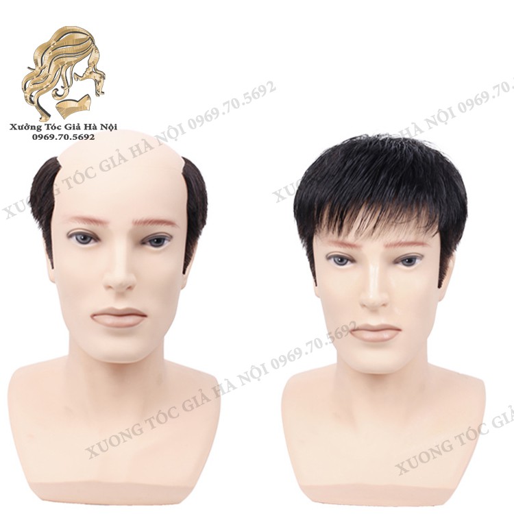Mái hói nam ❤️ 100% tóc thật ❤️ xưởng tóc giả Hà Nội