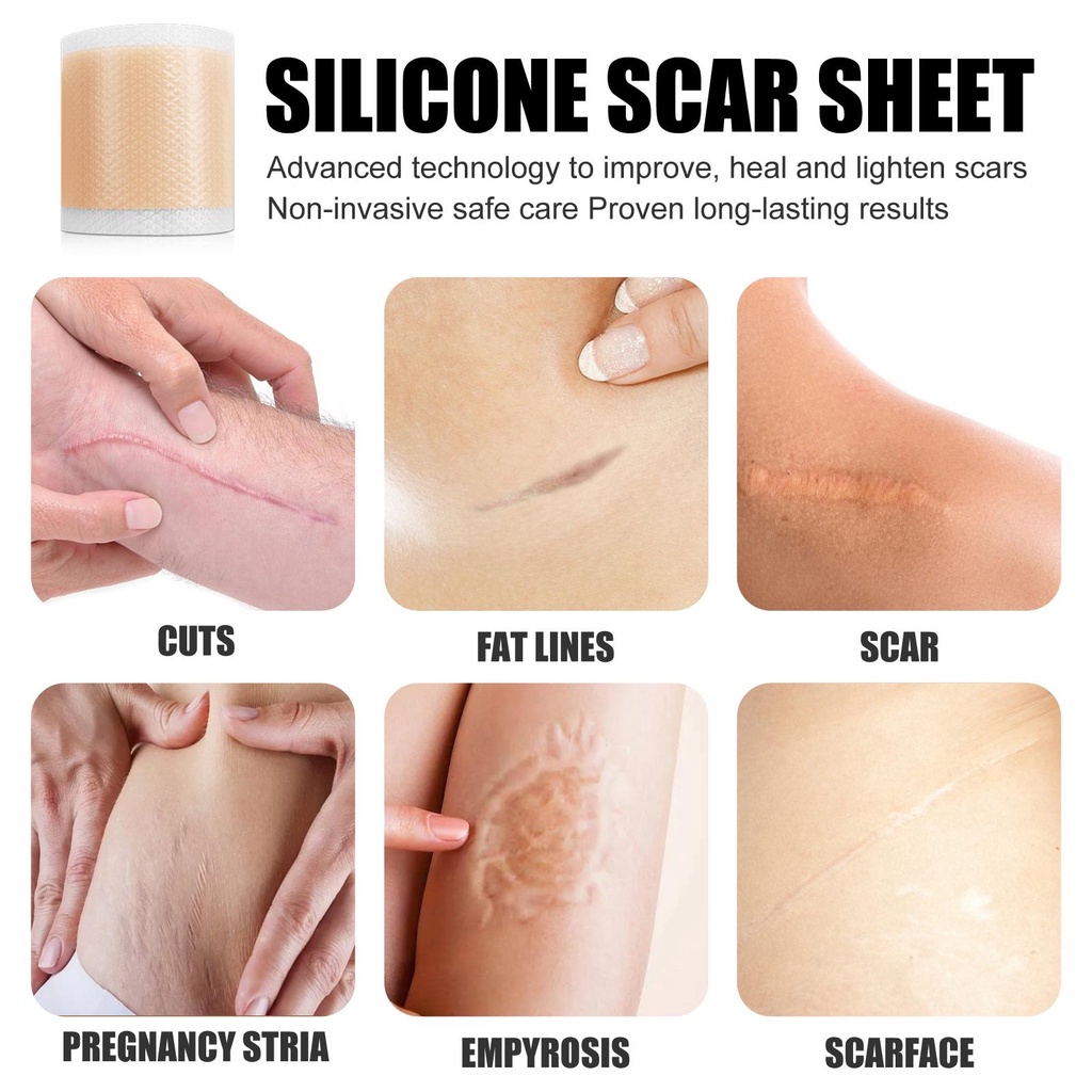 Miếng Dán Silicone Mềm Hỗ trợ giảm sẹo Có Thể Tái Sử Dụng N2K0