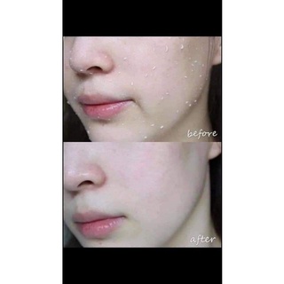 TẨY TẾ BÀO CHẾT RIORI - HONEY SCRUB