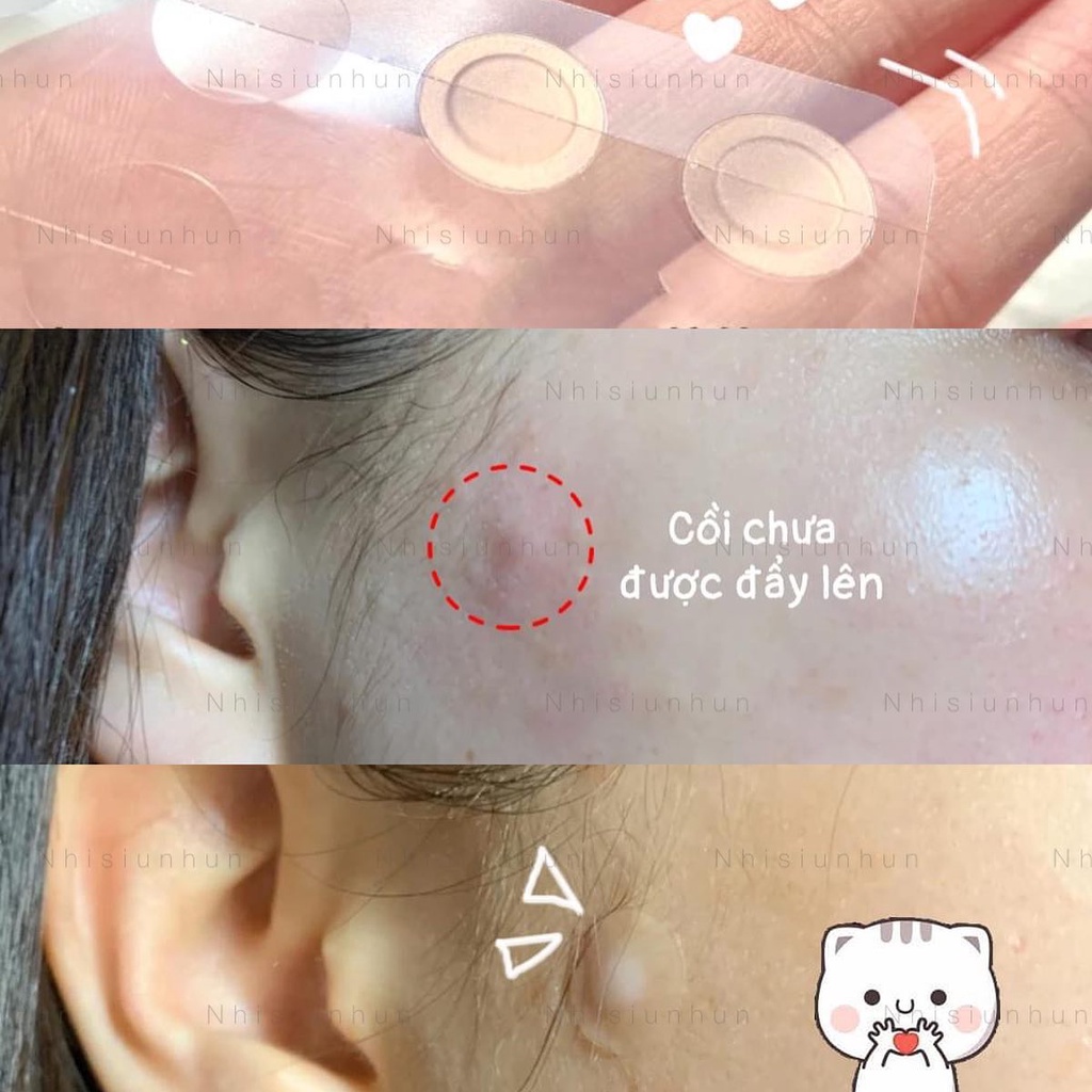 Miếng dán Some by mi Clear Spot patch